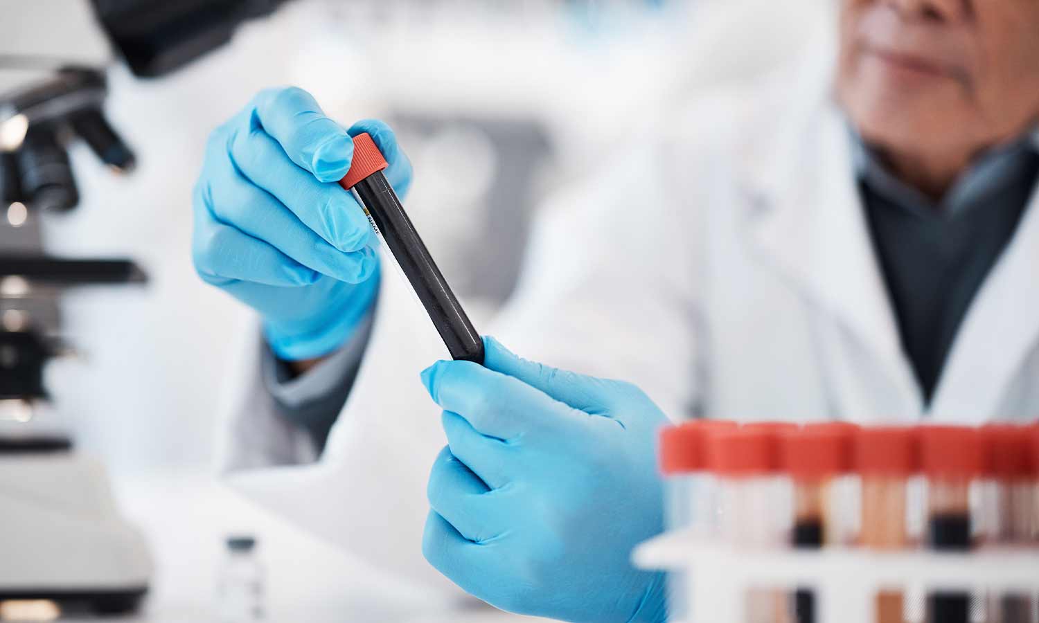 Vitaminetest? Waarom zou ik mijn bloed testen?